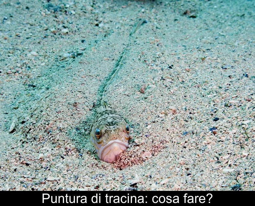 Puntura Di Tracina: Cosa Fare?