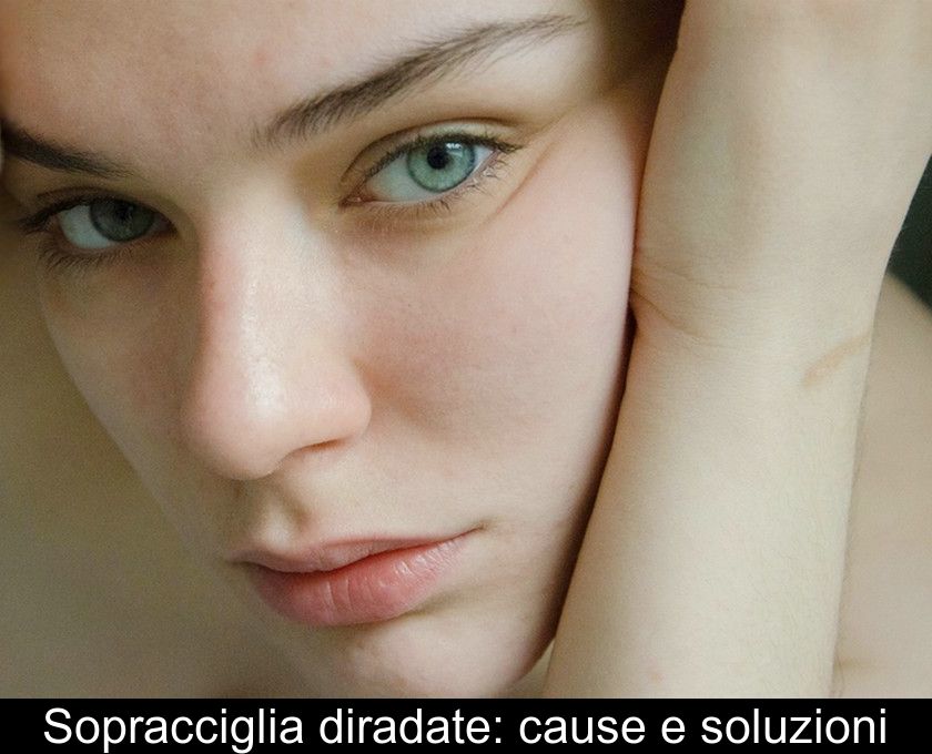 Sopracciglia Diradate: Cause E Soluzioni